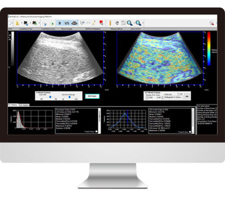 Software per ecografia - AmCAD-US - AmCad BioMed - di visualizzazione / diagnostico / di interpretazione