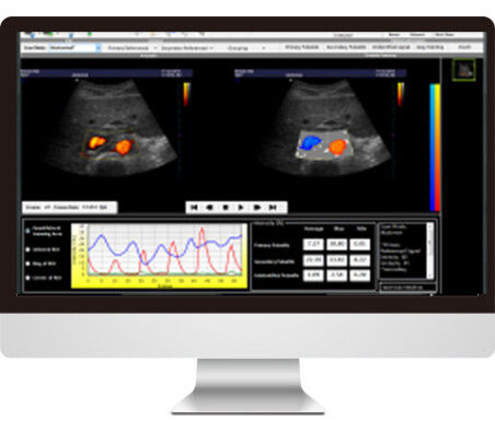 Software di analisi delle immagini - AmCAD-UV  - AmCad BioMed - di interpretazione / per ecografia / di vasi sanguigni