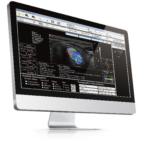 Software per ecografia - AmCAD-UT® - AmCad BioMed - di analisi delle immagini / di gestione / per reportistica