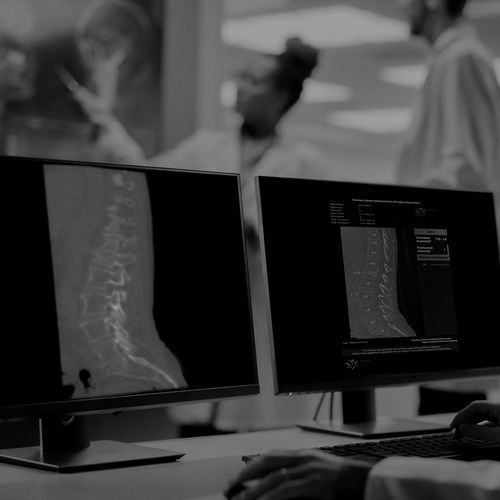 Software di diagnosi di fratture - IB Lab FLAMINGO - Imagebiopsy Lab - di trattamento / medico / clinico