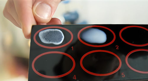 Kit di test per malattie infettive - 4095 - MEDIPAN GmbH - per malattie infiammatorie / di CRP / di proteina C-reattiva