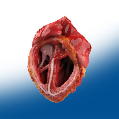 Modello anatomico di cuore - Ortho Baltic - per chirurgia / didattico