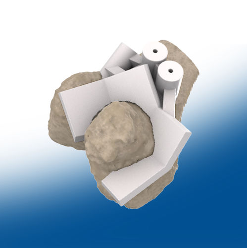 Dima di resezione per protesi di anca - 3D - Ortho Baltic
