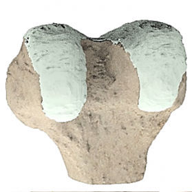 Modello anatomico per ginocchio - Ortho Baltic - per chirurgia