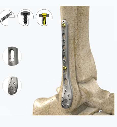 Placca di compressione per fibula - 1842 series - Zimed Medical - distale / laterale / bloccata