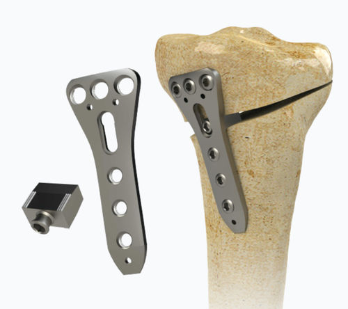 Placca per osteotomia per tibia - 1972-0016 - Zimed Medical - prossimale / mediale / bloccata