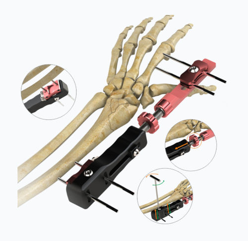 Fissatore esterno per polso - 5508-0000  - Zimed Medical - tubolare / per adulti