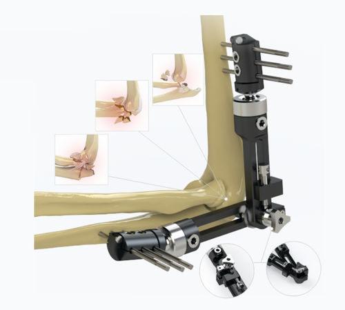 Fissatore esterno per gomito - 5934-0000 - Zimed Medical - tubolare / per adulti