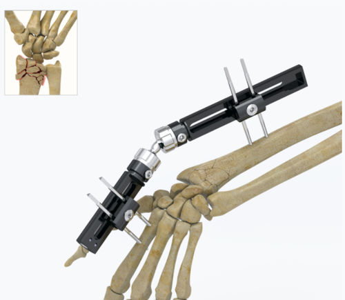 Fissatore esterno per polso - 5034 series - Zimed Medical - tubolare / per adulti