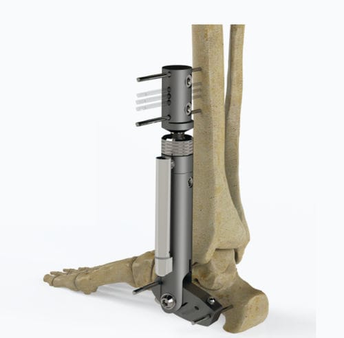 Fissatore esterno per caviglia - 5064-000 series - Zimed Medical - tubolare / per adulti