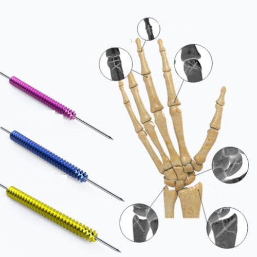 Vite per compressione ossea per mano - Zimed Medical - canalare / senza testa / in metallo