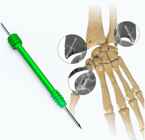 Vite per compressione ossea per mano - Zimed Medical - canalare