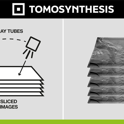 Software medico - Digital Tomosynthesis - Digitec - per radiografia / diagnostico / di post elaborazione