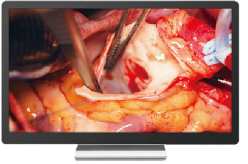 Monitor diagnostico - imedtac - chirurgico / 4K / 32"