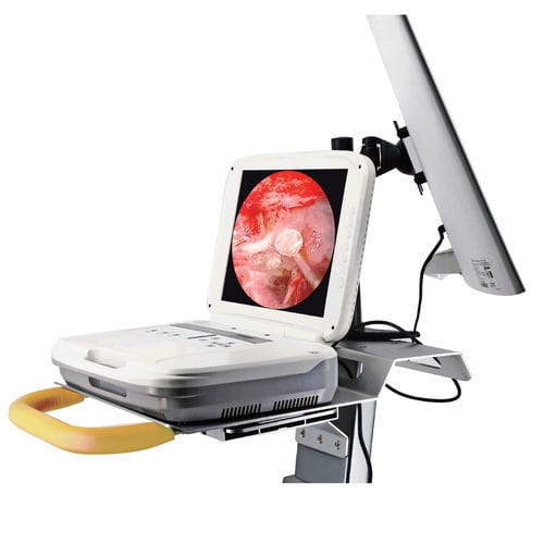 Colonna endoscopica per neurochirurgia endoscopica - 1080P - Hotry