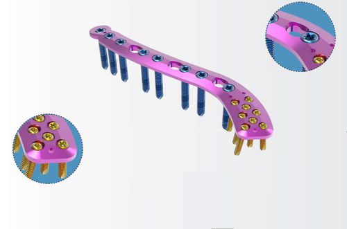 Placca di compressione per clavicola - TRUE LOCK Superior Distal Clavicle Anatomic - Truemed Medical - distale / bloccata / in metallo
