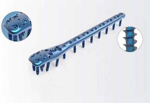 Placca di compressione per omero - TRUE LOCK Proximal Humerus - Truemed Medical - prossimale / bloccata / in metallo