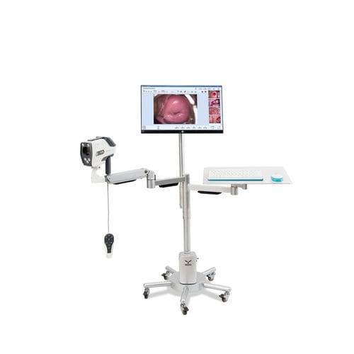 Videocolposcopio - YKD-3003 - AKX - su carrello