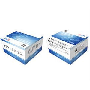 Test rapido per diagnosi COVID-19 - Zhongshan Chuangyi Biochemical Engineering Co.,ltd - d'IgG / di IgM / SARS-COV-2