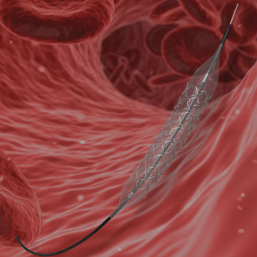 Stent coronarico - TwinRap - SLTL Medical - polimerico / in acciaio inossidabile / per somministrazione di farmaci
