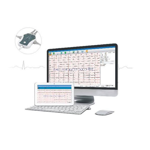 Sistema di gestione di dati - PCECG  - Rencare - ECG