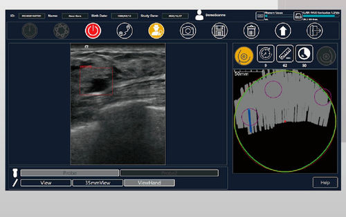 Software per ecografia - BR-FHUS Navigation™ - TaiHao Medical - visualizzatore / diagnostico / per screening del tumore al seno