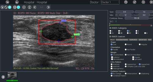 Software di analisi delle immagini - BU-CAD™ - TaiHao Medical - per reportistica / diagnostico / di interpretazione