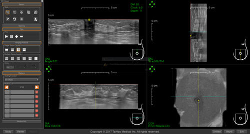 Software per reportistica - BR-Viewer™ - TaiHao Medical - visualizzatore / diagnostico / per screening del tumore al seno