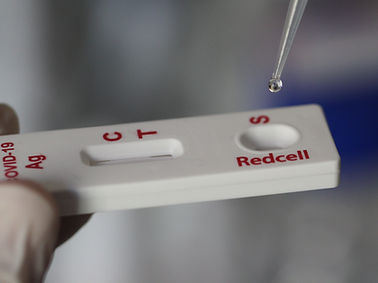 Test rapido per diagnosi COVID-19 - RCCOVST   - Redcell Biotechnology - per anticorpi / SARS-COV-2 / nasale