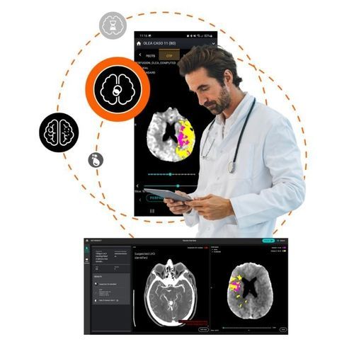 Software di trattamento - Olea Medical - medico / di emergenza