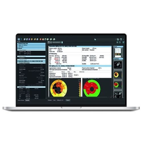Software di analisi - SPHERE® 3.0 - Olea Medical - di visualizzazione / di misura / di mappatura cardiaca