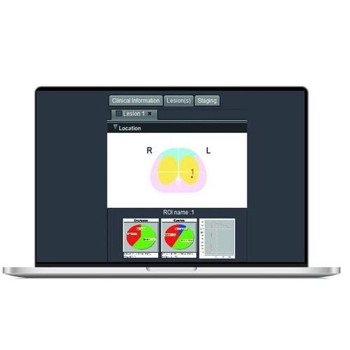 Software MRI - SPHERE® 3.0 - Olea Medical - di misura / di analisi delle immagini / di analisi di dati