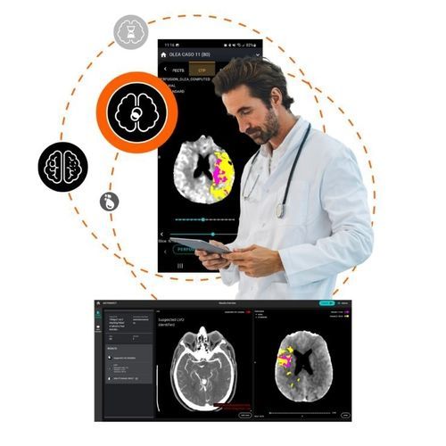 Software di analisi delle immagini - Olea Medical - medico / per tomografia computerizzata / di polmone