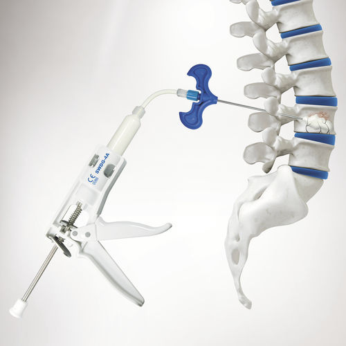 Strumentario chirurgico per iniezione di cemento osseo - SPASY BCD ™  - Seawon Meditech