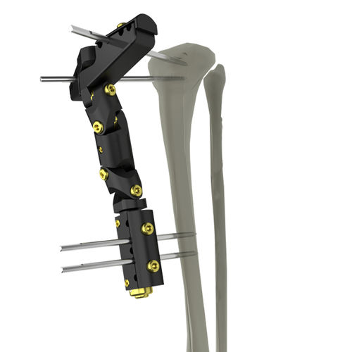 Fissatore esterno per tibia - UniX® - WishBone Medical - per femore / per omero / tubolare