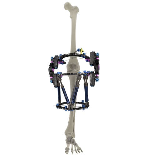 Fissatore esterno per ginocchio - WishBone Medical - circolare / per adulti