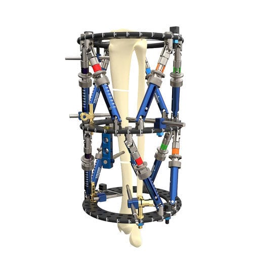 Fissatore esterno per tibia - Smart Correction®  - WishBone Medical - per fibula / per omero / circolare