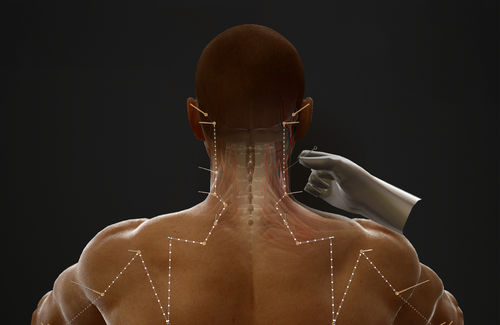 Software di visualizzazione - AcuMap - Medical Augmented Intelligence (MAI) - di trattamento / didattico / di cartografia