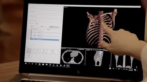 Software di visualizzazione 3D - DigiTwin - Medical Augmented Intelligence (MAI) - diagnostico / di condivisione / di trattamento