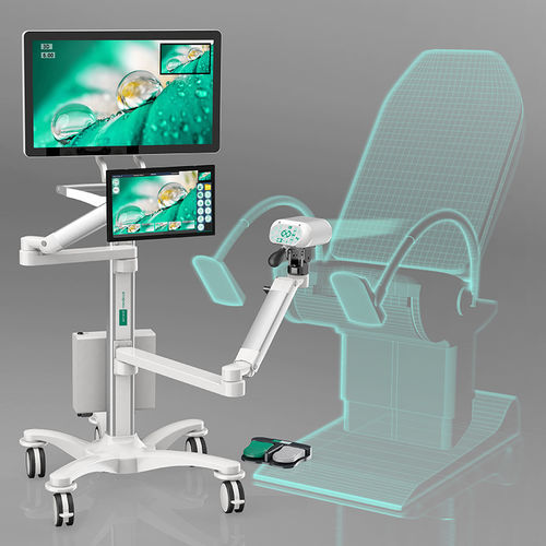 videocolposcopio - imed medical