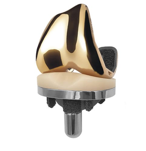 Protesi di ginocchio tricompartimentale - GKS PRIME Flex TRASER - Permedica Orthopaedics - a piatto mobile / non cementata