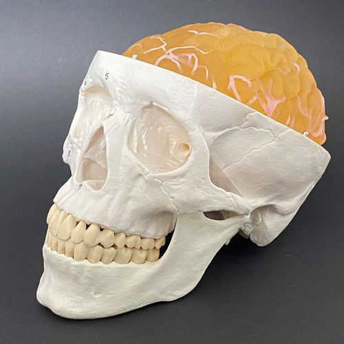 Modello anatomico di tumore - Schiner3DRepro - di cervello / neurochirurgico / didattico