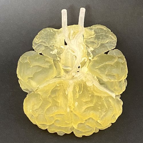 Modello anatomico di arteria - Circulus Willisii - Schiner3DRepro - del circolo arterioso di Willisii / di cervello / neurochirurgico