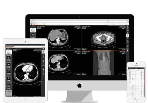 PACS per diagnostica per immagini - PACScenter - BMD Software - basato sul web