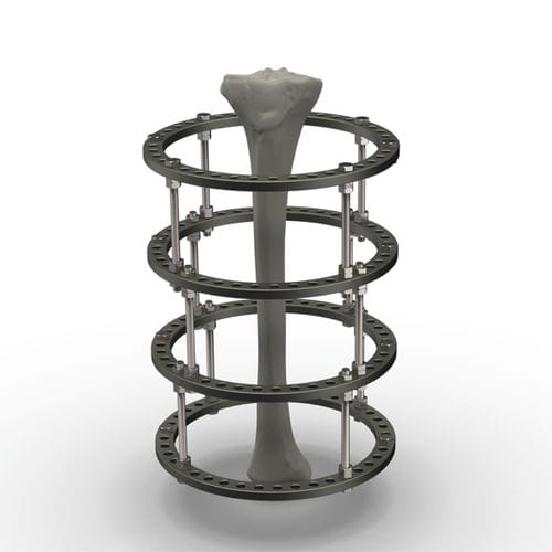 Fissatore esterno circolare - SFIR series - TASARIMMED - per tibia / per caviglia / per femore