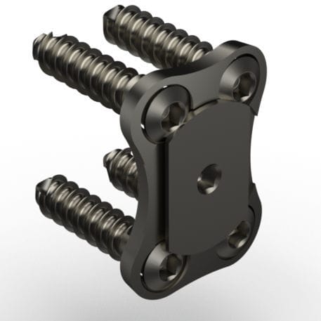 Placca per artrodesi cervicale - LPCS2 - TASARIMMED - bloccata / in metallo / 1 livello