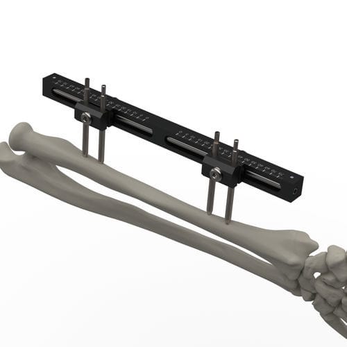 Fissatore esterno per polso - TF-ERS  - TASARIMMED - per radio / per ulna / tubolare