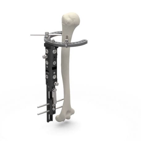 Fissatore esterno per tarso - MAF - TASARIMMED - per articolazione metacarpo-falangea / ibrido / pediatrico
