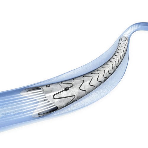 Stent ureterale - SURS series - Surgsci Medical - in metallo / con rivestimento