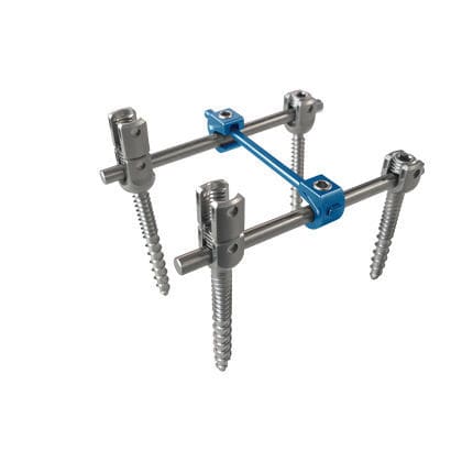 Sistema di osteosintesi toraco-lombare - Z5 - Changzhou Zener Medtec - via posteriore / per adulti